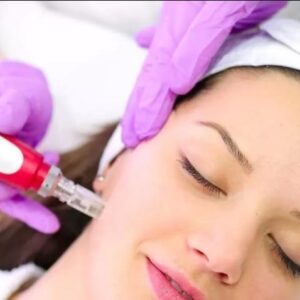 Máster Profesional en Microneedling con Dermapen