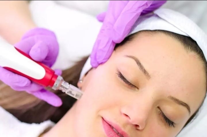 Máster Profesional en Microneedling con Dermapen